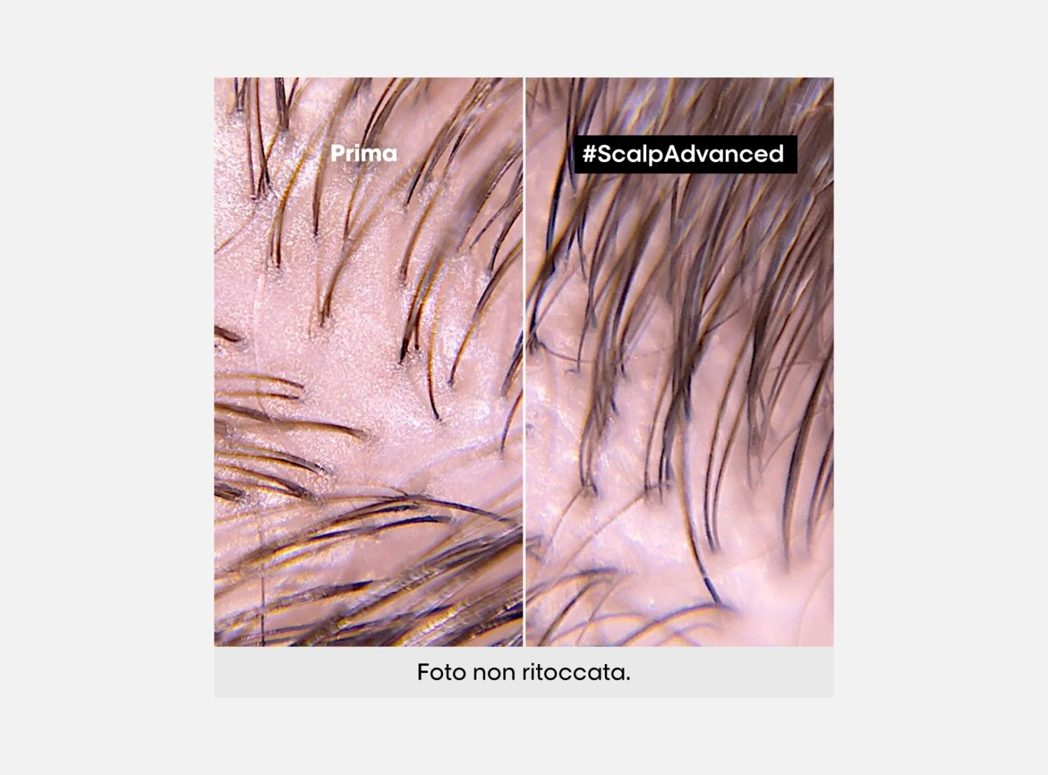 L’Oreal Professionnel Serie Expert Scalp Advanced 2-in-1 Deep Purifier Clay Anti-Oiliness Cute Grassa 250ml | 500ml 4 L’Oreal Professionnel Serie Expert Scalp Advanced 2-in-1 Deep Purifier Clay Anti-Oiliness Cute Grassa 250ml | 500ml - immagine 2