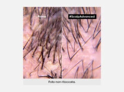 L’Oreal Professionnel Serie Expert Scalp Advanced Shampoo Anti-Dandruff Antiforfora 300ml | 500ml | 1500ml