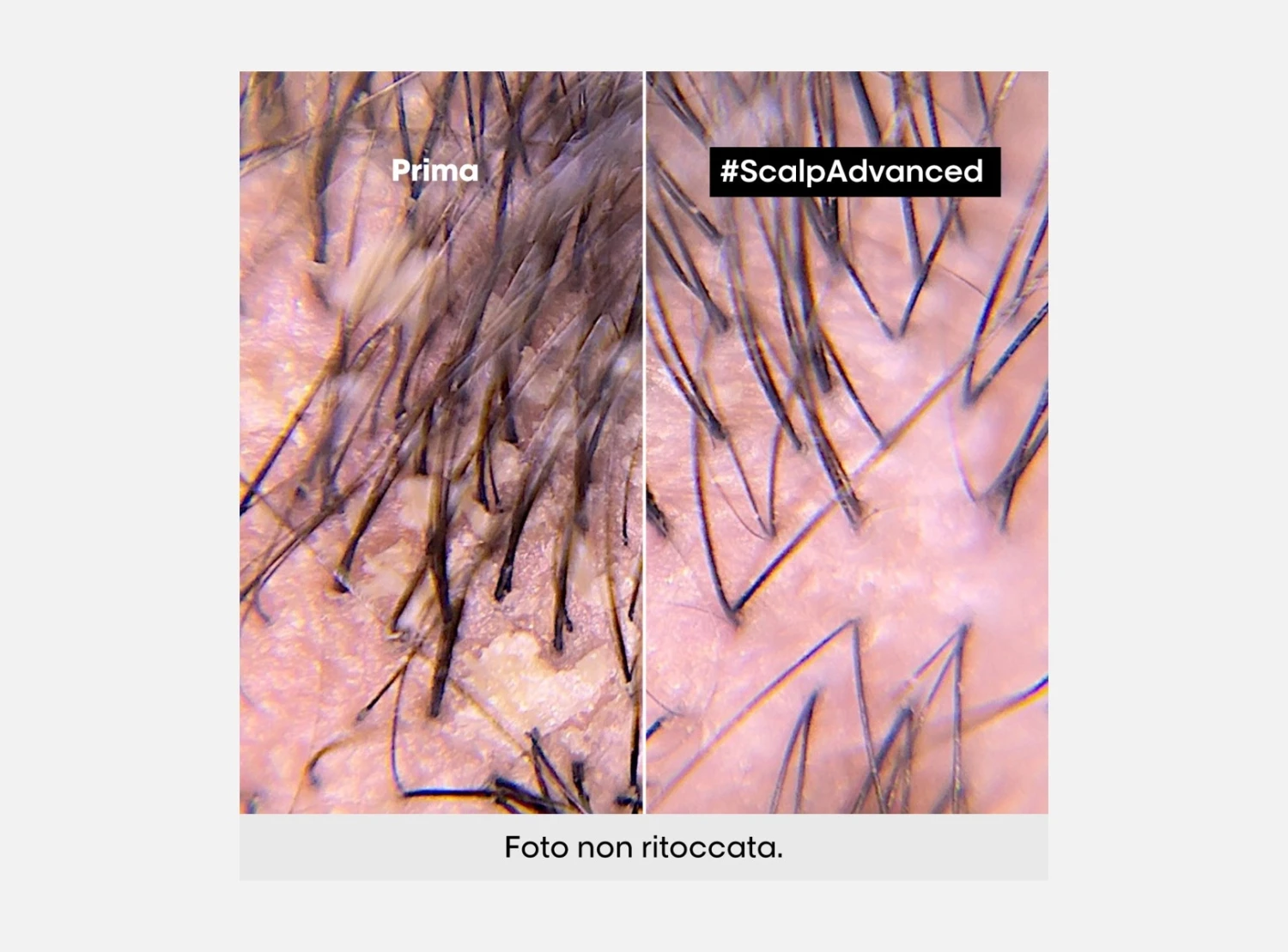 L’Oreal Professionnel Serie Expert Scalp Advanced Shampoo Anti-Dandruff Antiforfora 300ml | 500ml | 1500ml 3 L’Oreal Professionnel Serie Expert Scalp Advanced Shampoo Anti-Dandruff Antiforfora 300ml | 500ml | 1500ml