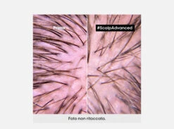 L'Oréal Professionnel Serie Expert Scalp Advanced Trattamento Anti-Discomfort Cute Sensibile 200ml