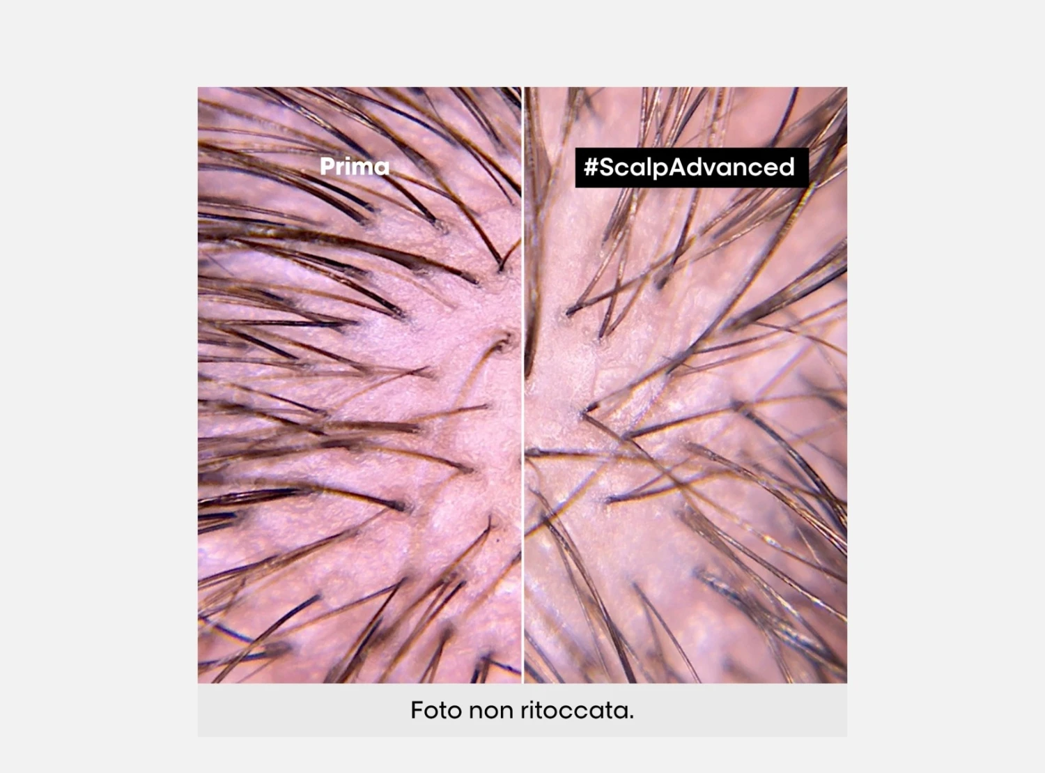 L'Oréal Professionnel Serie Expert Scalp Advanced Trattamento Anti-Discomfort Cute Sensibile 200ml 3 L'Oréal Professionnel Serie Expert Scalp Advanced Trattamento Anti-Discomfort Cute Sensibile 200ml