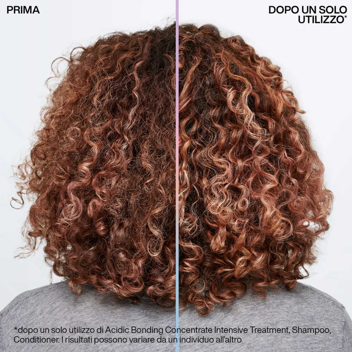 Redken Abc Acidic Bonding Concentrate Pre-Treatment 150ml Pre-shampoo Riparatore Capelli Trattati E Rovinati 5 Redken Abc Acidic Bonding Concentrate Pre-Treatment 150ml Pre-shampoo Riparatore Capelli Trattati E Rovinati - immagine 3