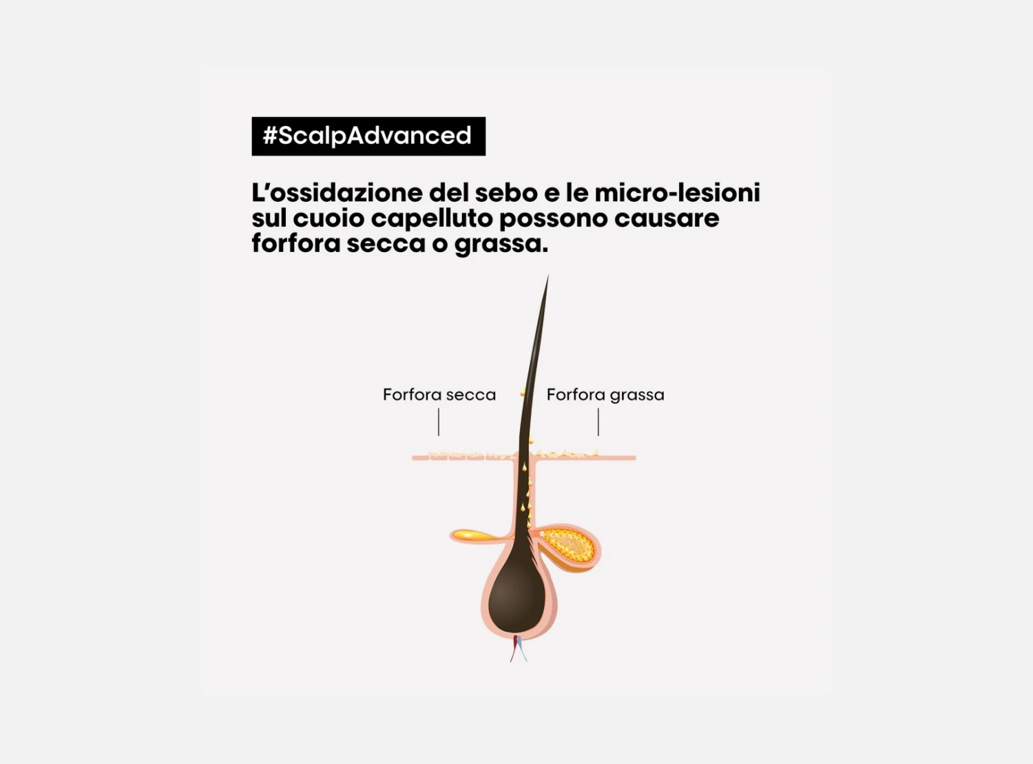 L’Oreal Professionnel Serie Expert Scalp Advanced Shampoo Anti-Dandruff Antiforfora 300ml | 500ml | 1500ml 4 L’Oreal Professionnel Serie Expert Scalp Advanced Shampoo Anti-Dandruff Antiforfora 300ml | 500ml | 1500ml - immagine 2