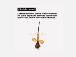 L’Oreal Professionnel Serie Expert Scalp Advanced 2-in-1 Deep Purifier Clay Anti-Oiliness Cute Grassa 250ml | 500ml 10 L’Oreal Professionnel Serie Expert Scalp Advanced 2-in-1 Deep Purifier Clay Anti-Oiliness Cute Grassa 250ml | 500ml -Bellezza e Lusso scalp advanced 2 in 1 deep purifier clay anti oiliness l oreal sconto