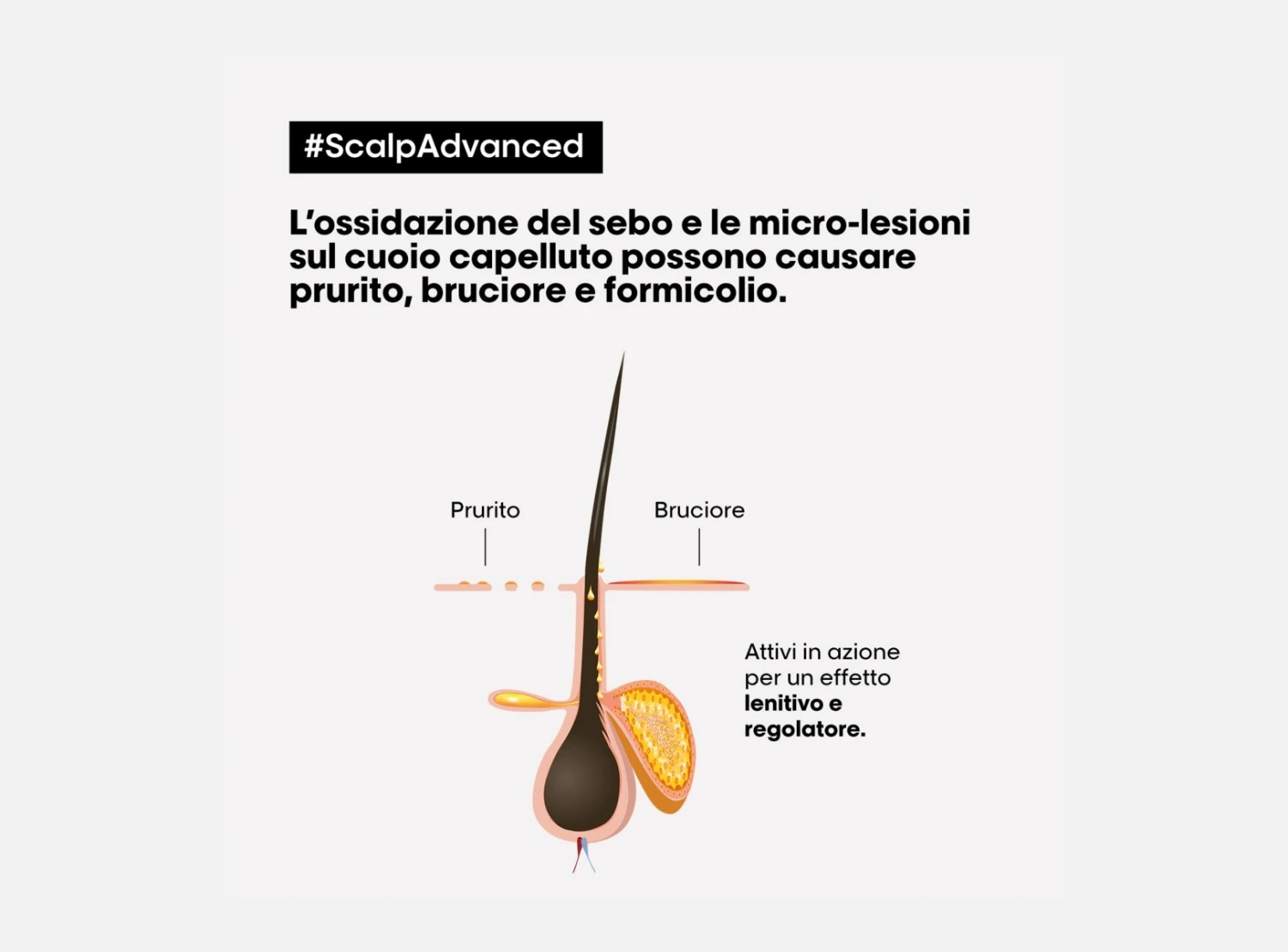 L'Oréal Professionnel Serie Expert Scalp Advanced Trattamento Anti-Discomfort Cute Sensibile 200ml 7 L'Oréal Professionnel Serie Expert Scalp Advanced Trattamento Anti-Discomfort Cute Sensibile 200ml - immagine 5